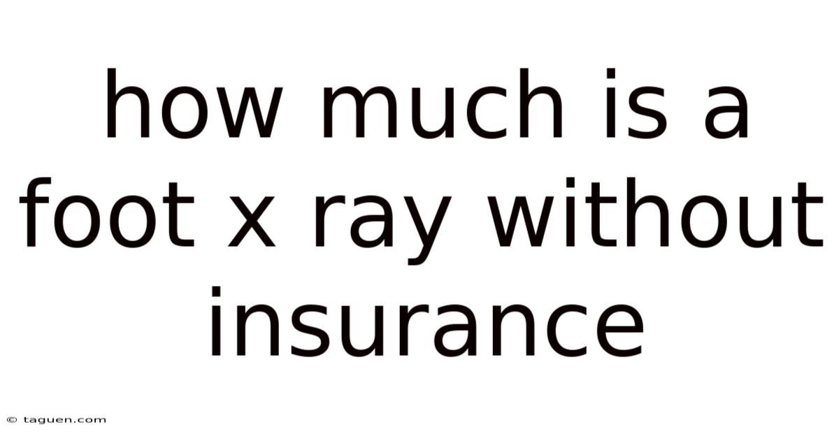 How Much Is A Foot X Ray Without Insurance How Much Is A Foot X Ray Without Insurance
